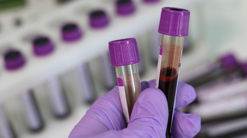 1 op de 5 Nederlandse bloeddonoren heeft antistoffen tegen coronavirus